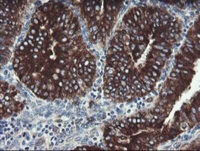 Immunohistochemistry: TPD52L3/D55 Antibody (OTI8C12) - Azide and BSA Free [NBP2-74567]