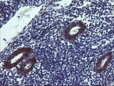 Immunohistochemistry: TPD52L3/D55 Antibody (OTI8C12) - Azide and BSA Free [NBP2-74567]