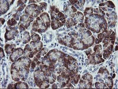 Immunohistochemistry: TPD52L3/D55 Antibody (OTI8C12) - Azide and BSA Free [NBP2-74567]