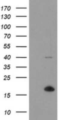 Western Blot: TPD52L3/D55 Antibody (OTI8C12)Azide and BSA Free [NBP2-74567]