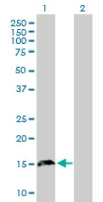 Western Blot: TPD52L3/D55 Antibody [H00089882-B01P]