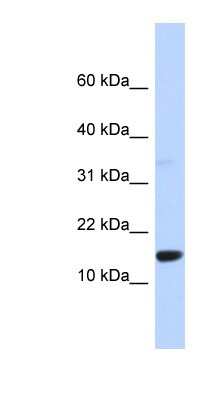 Western Blot: TPD52L3/D55 Antibody [NBP1-56498]