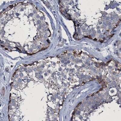 Immunohistochemistry-Paraffin: TPGS2 Antibody [NBP1-85062]