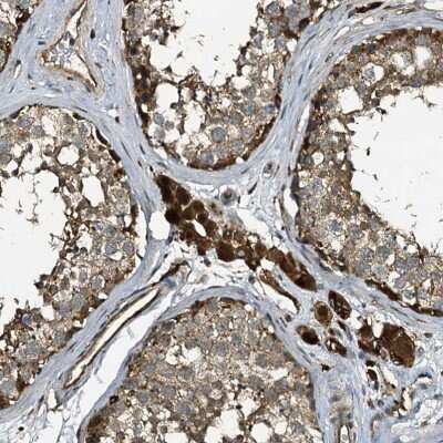 Immunohistochemistry-Paraffin: TPGS2 Antibody [NBP1-85063]