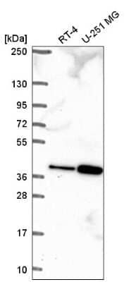 Western Blot: TPGS2 Antibody [NBP2-57557]