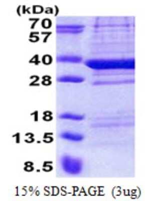 SDS-PAGE: Recombinant Human TPGS2 His Protein [NBP2-22899]