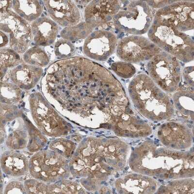 Immunohistochemistry: TPK1 Antibody [NBP1-83151]