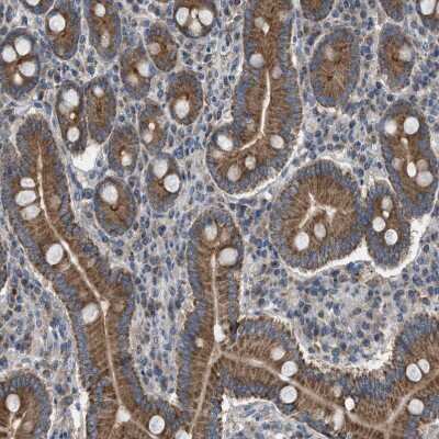 Immunohistochemistry: TPK1 Antibody [NBP1-83152]
