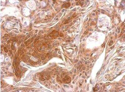 Immunohistochemistry-Paraffin: TPK1 Antibody [NBP1-32248]