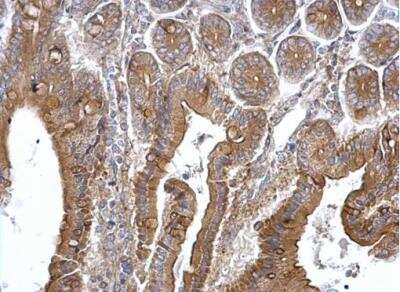 Immunohistochemistry-Paraffin: TPK1 Antibody [NBP1-32248]