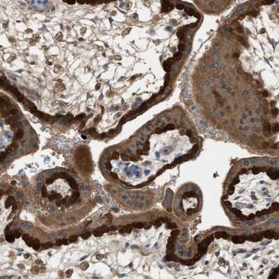 Immunohistochemistry-Paraffin: TPK1 Antibody [NBP1-83151]