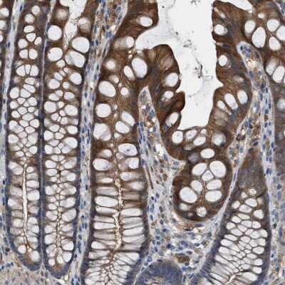 Immunohistochemistry-Paraffin: TPK1 Antibody [NBP1-83151]
