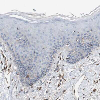 Immunohistochemistry-Paraffin: TPK1 Antibody [NBP1-83151]
