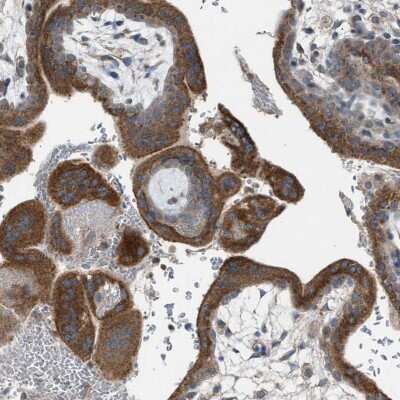 Immunohistochemistry-Paraffin: TPK1 Antibody [NBP1-83152]