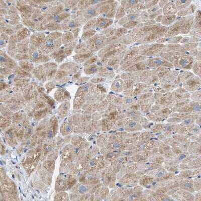 Immunohistochemistry-Paraffin: TPK1 Antibody [NBP1-83152]