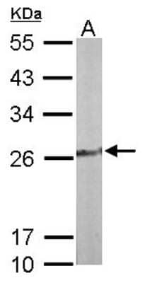 Western Blot: TPK1 Antibody [NBP1-32248]