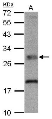 Western Blot: TPK1 Antibody [NBP1-32248]