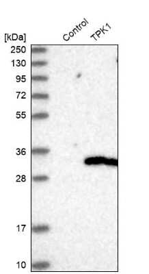 Western Blot: TPK1 Antibody [NBP1-83152]