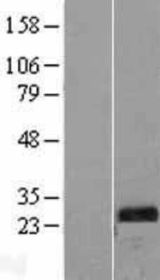 Western Blot: TPK1 Overexpression Lysate [NBL1-17218]