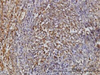 Immunohistochemistry-Paraffin: TPMT Antibody (1B5) [H00007172-M01]