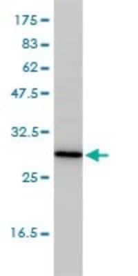 Western Blot: TPMT Antibody (1B5) [H00007172-M01]