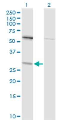 Western Blot: TPMT Antibody (1B5) [H00007172-M01]