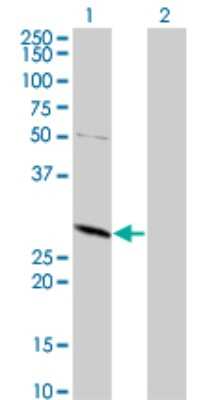 Western Blot: TPMT Antibody (1D4) [H00007172-M02]