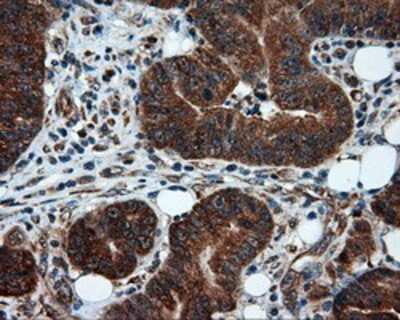Immunohistochemistry-Paraffin: TPMT Antibody (OTI2A2) [NBP2-02356]