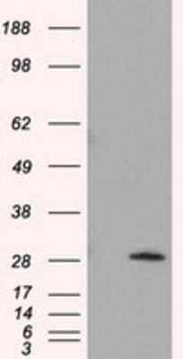 Western Blot: TPMT Antibody (OTI2A2) [NBP2-02356]