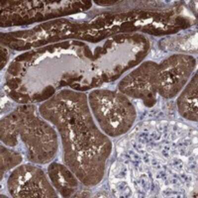 Immunohistochemistry-Paraffin: TPMT Antibody [NBP3-17776]