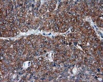 Immunohistochemistry: TPMT Antibody (OTI2A2) - Azide and BSA Free [NBP2-74570]