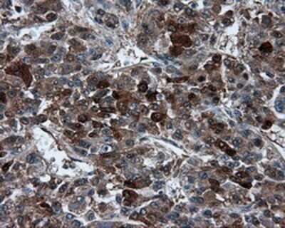 Immunohistochemistry: TPMT Antibody (OTI2A2) - Azide and BSA Free [NBP2-74570]