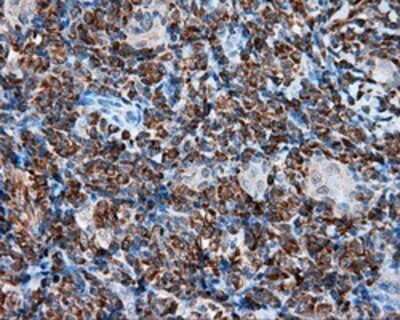 Immunohistochemistry: TPMT Antibody (OTI2A2) - Azide and BSA Free [NBP2-74570]