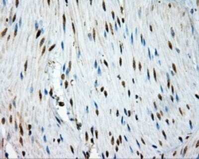 Immunohistochemistry: TPMT Antibody (OTI2A2) - Azide and BSA Free [NBP2-74570]