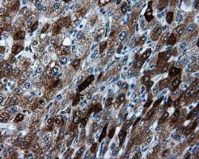 Immunohistochemistry: TPMT Antibody (OTI2A2) - Azide and BSA Free [NBP2-74570]
