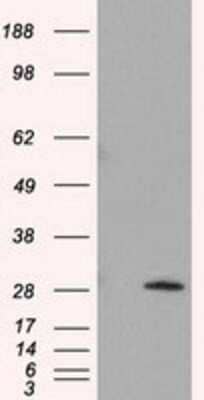 Western Blot: TPMT Antibody (OTI2A2)Azide and BSA Free [NBP2-74570]