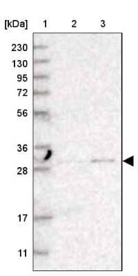 Western Blot: TPMT Antibody [NBP1-86032]