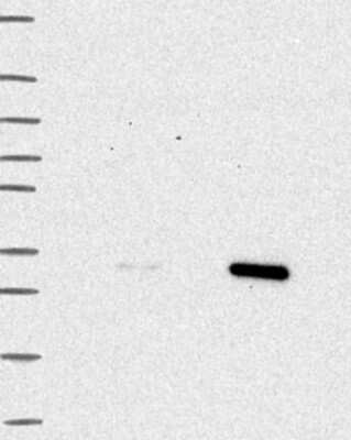 Western Blot: TPMT Antibody [NBP3-17776]