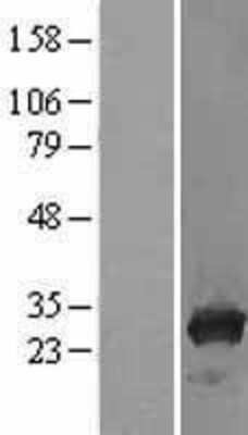 Western Blot: TPMT Overexpression Lysate [NBL1-17222]