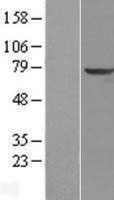 Western Blot: Tripeptidyl-Peptidase I/TPP1 Overexpression Lysate [NBL1-17223]