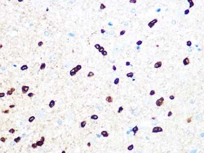 Immunohistochemistry-Paraffin: TPPP/p25 Antibody (3S5U9) [NBP3-16454]