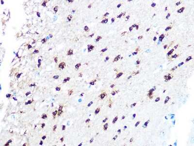 Immunohistochemistry-Paraffin: TPPP/p25 Antibody (3S5U9) [NBP3-16454]