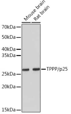 Western Blot: TPPP/p25 Antibody (3S5U9) [NBP3-16454]