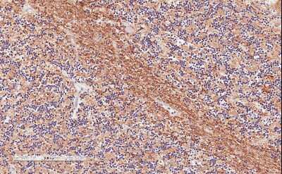 Immunohistochemistry-Paraffin: TPPP/p25 Antibody [NBP1-49833]
