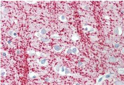 Immunohistochemistry-Paraffin: TPPP/p25 Antibody [NBP1-49833]