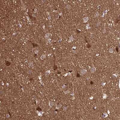 Immunohistochemistry-Paraffin: TPPP/p25 Antibody [NBP1-80962]