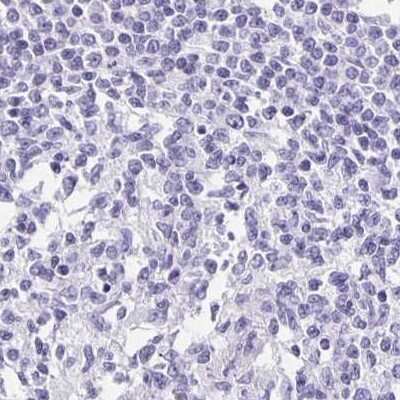 Immunohistochemistry-Paraffin: TPPP/p25 Antibody [NBP1-80962]