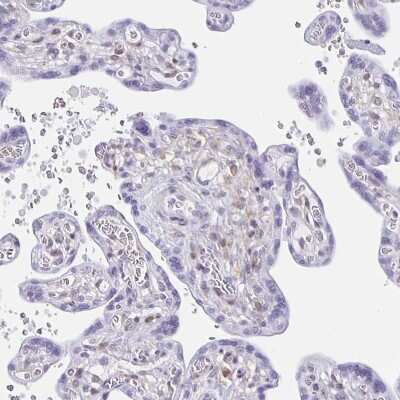 Immunohistochemistry-Paraffin: TPPP/p25 Antibody [NBP1-80962]