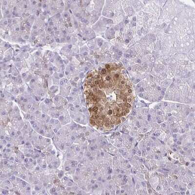 Immunohistochemistry-Paraffin: TPPP/p25 Antibody [NBP1-80962]
