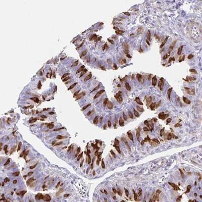 Immunohistochemistry-Paraffin: TPPP/p25 Antibody [NBP1-80962]